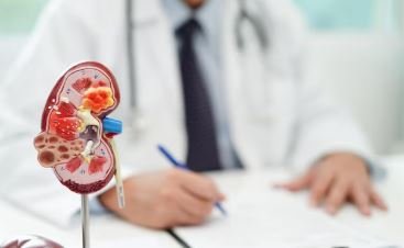 Kidney Stone