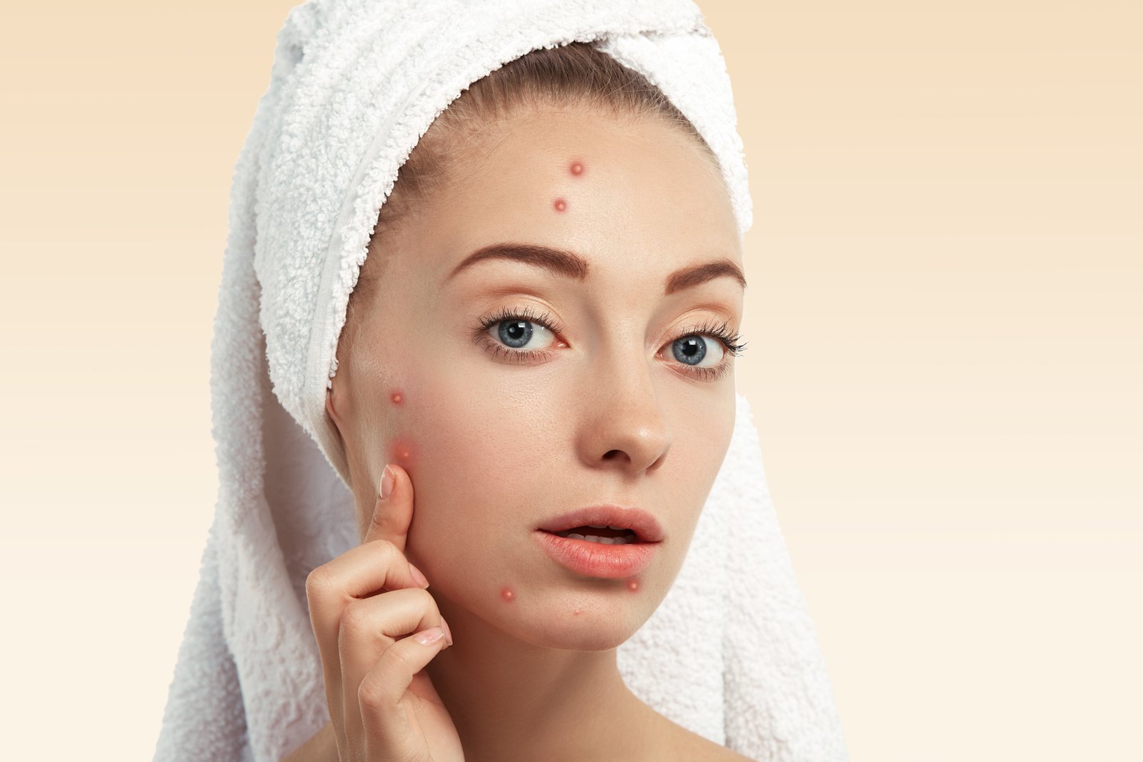 Skin Problems